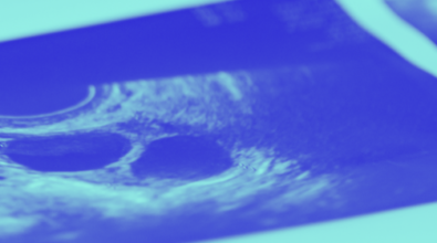 Ultrasound images