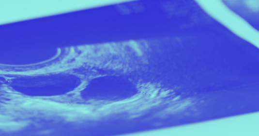 Ultrasound images